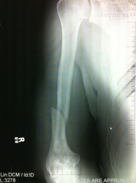 RAdiografia Antonio Rodrigo