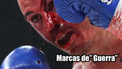 Photo of La cara de Zambidis después de su combate