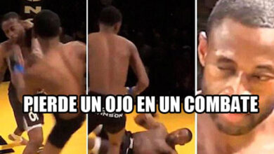 Photo of Pierde un ojo en un combate de MMA -Video