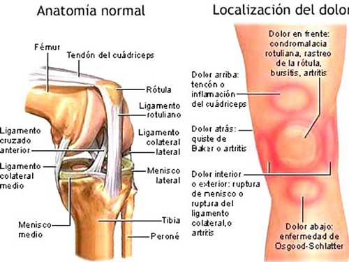 Dolor-de-rodilla