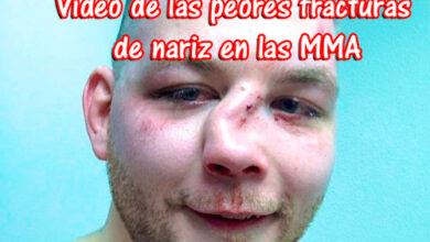 Photo of Video de las peores fracturas de nariz en las MMA