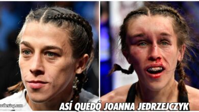 Photo of Foto | Joanna Jedrzejczyk antes y después de la guerra UFC 248 con Weili Zhang